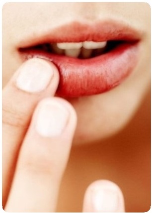 лечение обветренных губ